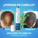 OFERTA 2X1 🧬 CRECE CABELLO BODYWISE ORIGINAL🌱✨ +ENVÍO GRATIS 💯