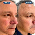 OFERTA 2x1 Quita Verrugas y Manchas FORMUCLEAR+ENVIO GRATIS