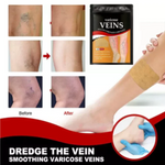 OFERTA 3x1 Nuevo Quita Varices Parches+ENVIO GRATIS