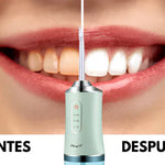 OFERTA 2x1 ANTI CARIES Y QUITA MANCHAS DENTALES+ENVIO GRATIS