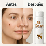 OFERTA 2X1+ 🐝QUITA VERRUGAS + ENVÍO GRATIS 🚀 💨