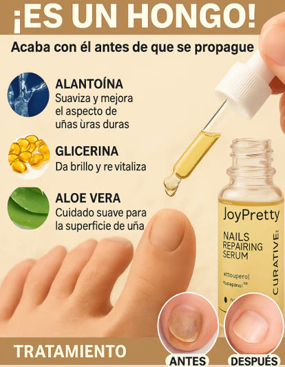 JoyPretty 2X1 ¡Elimina los hongos de tus uñas al instante! +ENVÍO GRATIS