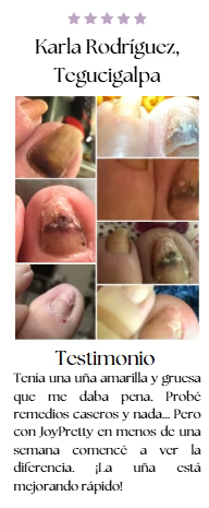 JoyPretty 2X1 ¡Elimina los hongos de tus uñas al instante! +ENVÍO GRATIS