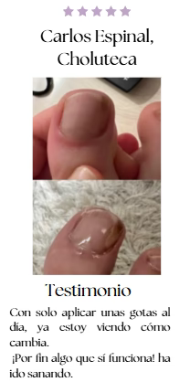 JoyPretty 2X1 ¡Elimina los hongos de tus uñas al instante! +ENVÍO GRATIS