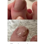 JoyPretty 2X1 ¡Elimina los hongos de tus uñas al instante! +ENVÍO GRATIS