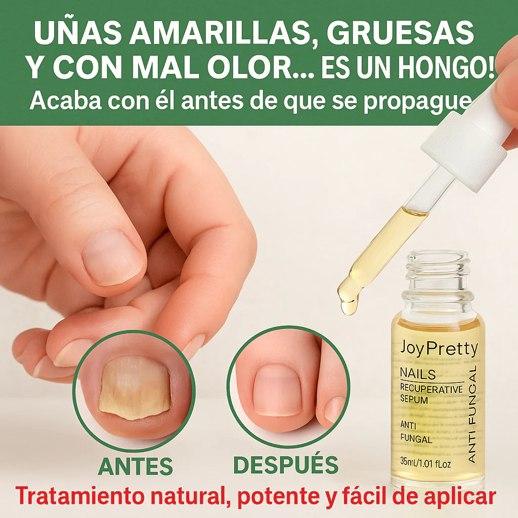 JoyPretty 2X1 ¡Elimina los hongos de tus uñas al instante! +ENVÍO GRATIS