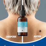 OFERTA 2x1 Quita Verrugas y Manchas VERRYCLEAN+ENVIO GRATIS