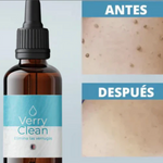 OFERTA 2x1 Quita Verrugas y Manchas VERRYCLEAN+ENVIO GRATIS