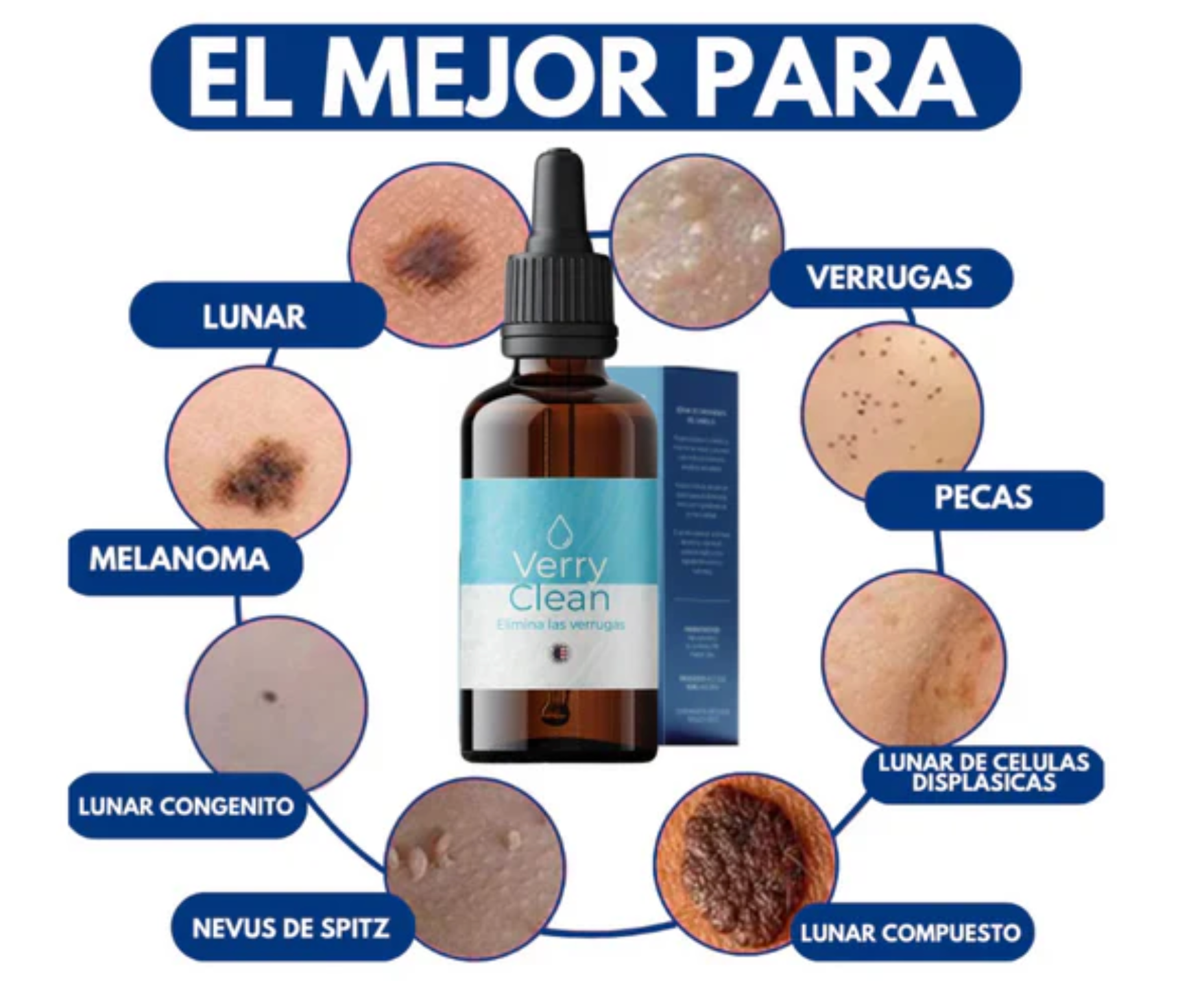 OFERTA 2x1 Quita Verrugas y Manchas VERRYCLEAN+ENVIO GRATIS