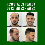 OFERTA 2x1 CRECE CABELLO 🌱✨REDUCTOR DE CAÍDA ACEITE BATANA+ENVÍO GRATIS⭐