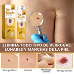 OFERTA 2X1+ 🐝QUITA VERRUGAS + ENVÍO GRATIS 🚀 💨